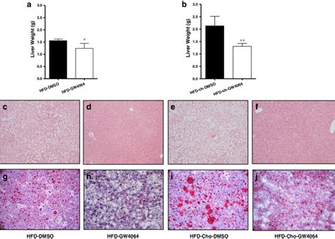 Gw4064 Repressed Hfd Induced Hepatic Steatosis At The End Of The