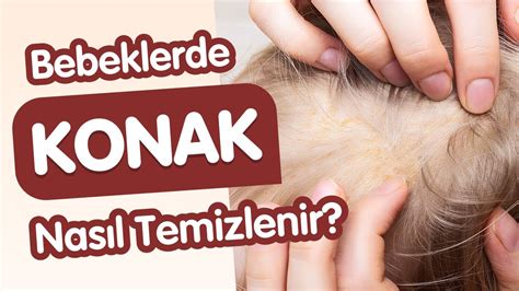 Deride Sarı Döküntüler Konak nedir Nasıl Temizlenir YouTube