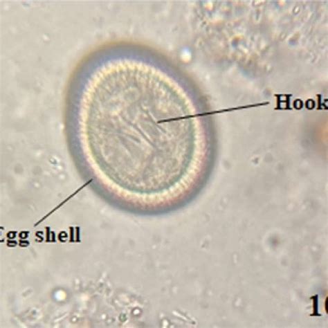 Diagram of the domestic life cycle of E. granulosus.. | Download Scientific Diagram