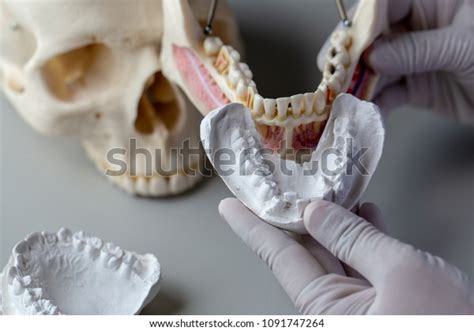 Study Cast Diagnostic Cast Dental Gypsum Stock Photo 1091747264 ...