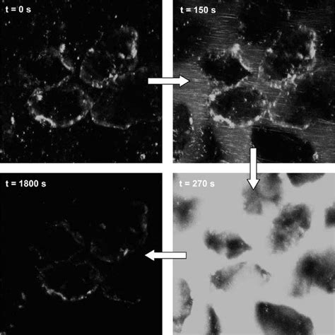 Confocal Laser Micrographs Showing Direct Evidence For The Detachment