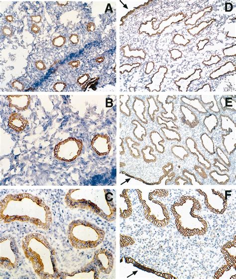 Examples Of Endometrial Tissue From Proliferative A C And Secretory