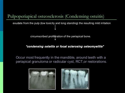 Periapical Pathology 22 1