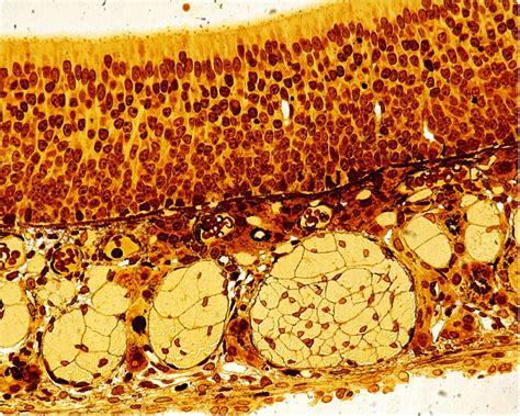 Olfactory Epithelium Histology