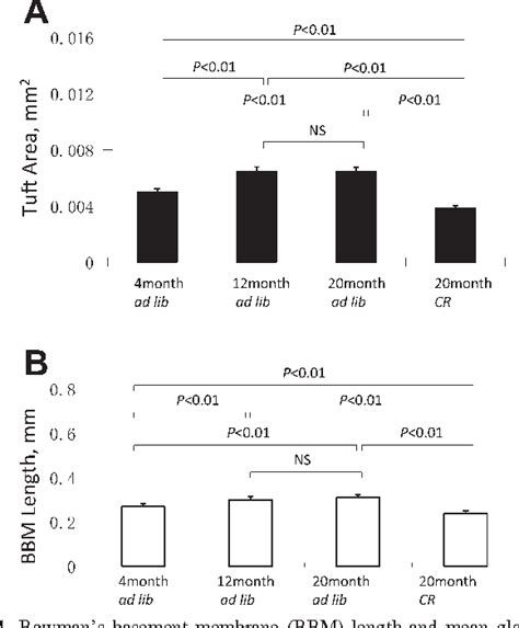 Figure 1 From De Novo Expression Of Podocyte Proteins In Parietal