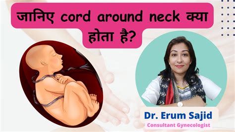 Cord Around Neck Dr Erum Hassan Clinic Best Gynaecologist Patna Bihar