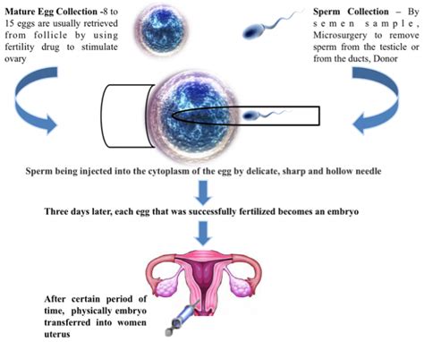 Icsi Fertility Treatment Best Icsi Specialist In Noida Zeeva Clinic