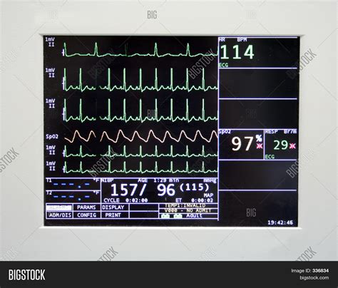 Cardiac Monitor Image & Photo | Bigstock