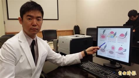 早期篩檢發現食道癌 內視鏡治療免開刀 自由健康網