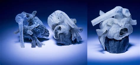 MRI Scans Used To Create 3D Printed Hearts For Surgery Practice