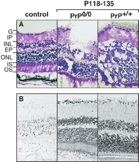 Neurotoxic Effects Of The Nonfibrillar Prp Fragment P On