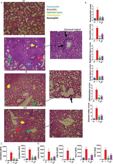 Frontiers Prophylactic Treatment Of Glycyrrhiza Glabra Mitigates