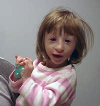 PICTURES - Primordial Dwarfism