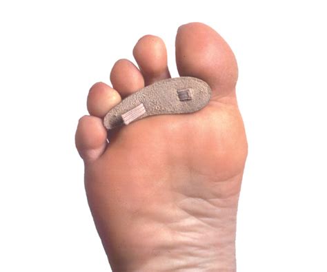 Pedifix Hammer Toe Cushion Felt The Verne Bintz Company