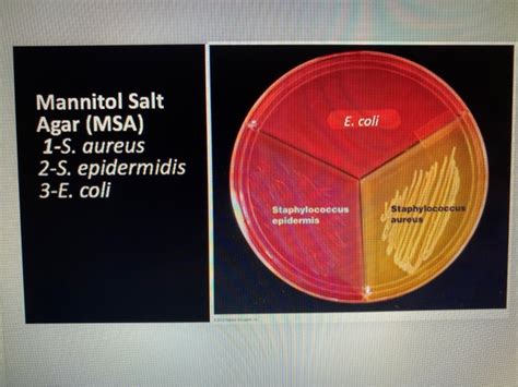 Solved Mannitol Salt Agar (MSA) - Looking at the selective | Chegg.com