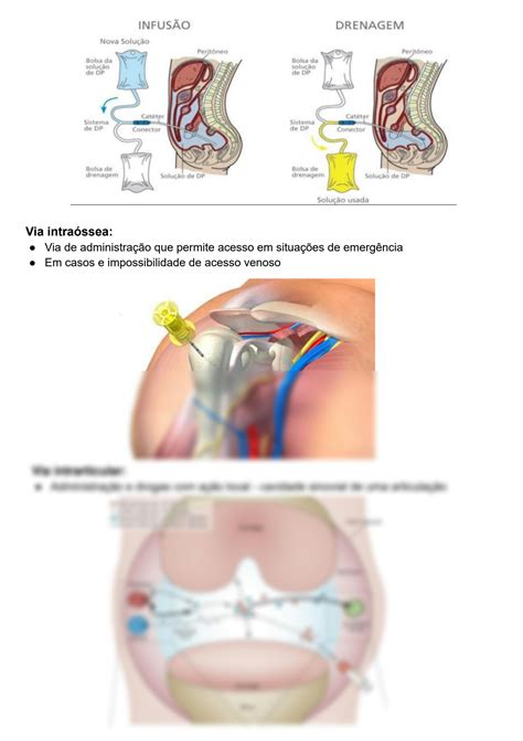 Solution Farmacocin Tica Vias De Administra O Studypool