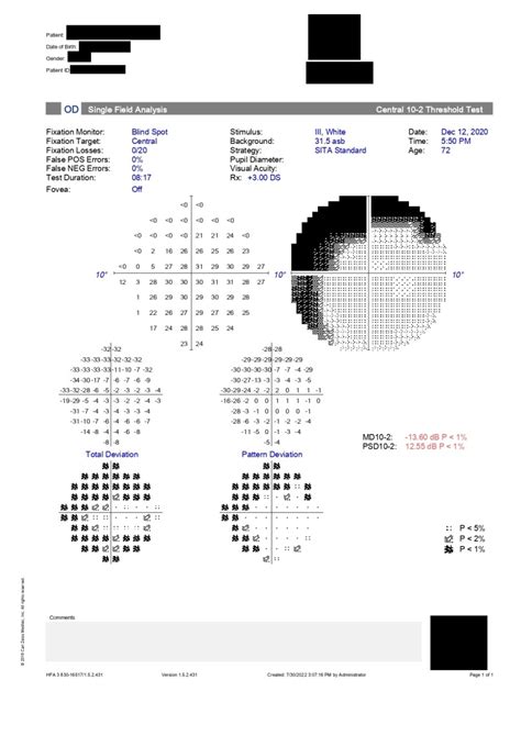 Figure Humphrey Visual Field Printout Test Statpearls