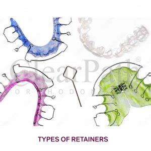 Retainers After Braces The Complete Guide