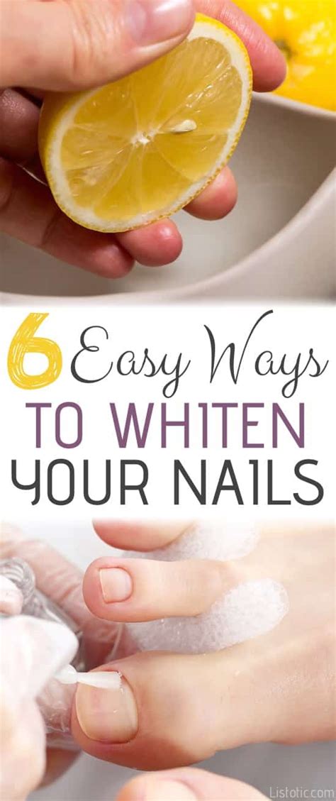 Best Ways To Whiten Your Nails So Easy And They Actually Work