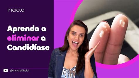 Candidíase Vaginal de Repetição O Que Fazer YouTube