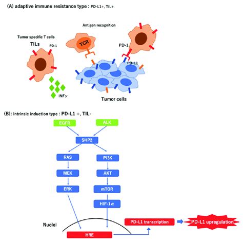 Different Types Of Tumor Microenvironment In Pd L1 Positive Tumors A