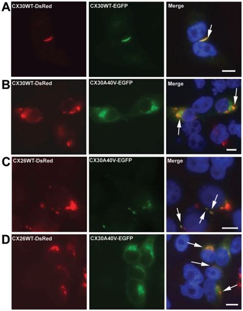 A Tet On HeLa Cells Co Expressing CX30WT DsRed And CX30WT EGFP