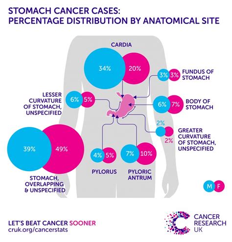 6 Warning Signs Of Stomach Cancer Health