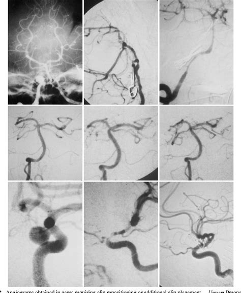 Structure Of Superior Hypophyseal Artery Semantic Scholar