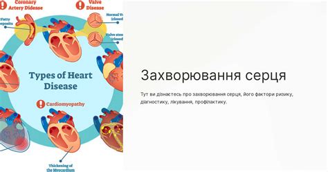 Захворювання серця