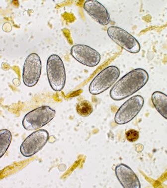 Parasitology Exam 2 Flashcards Quizlet