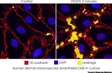 Permeability Of The Endothelial Barrier Identifying And Reconciling