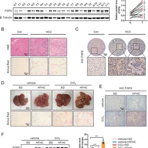 Increased Fgf9 Expression In Human Hcc Samples And Nash‐driven Hcc Mice