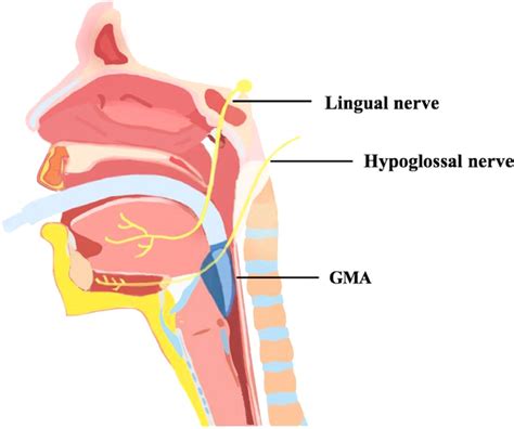 SciELO Brasil Unilateral Lingual Nerve And Hypoglossal Nerve Injury