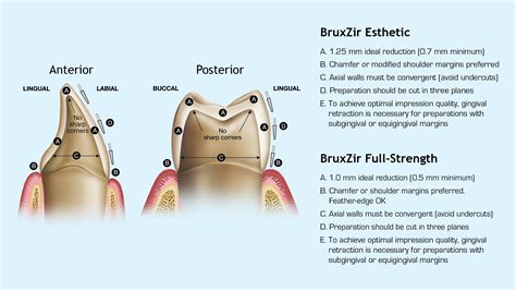 How To Prep And Cement Bruxzir® Zirconia Crowns New West