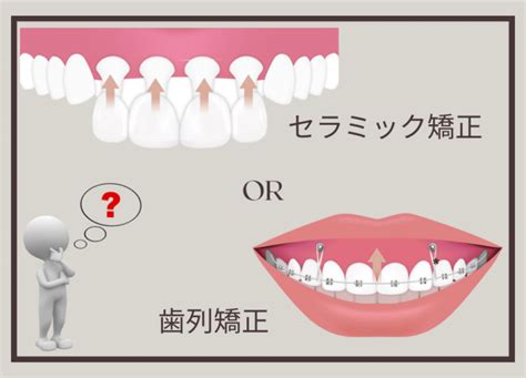 セラミック矯正と歯列矯正（ワイヤー・マウスピース）どちらがおすすめ？ 大阪でセラミック矯正をするなら「ヤスデンタルクリニック」