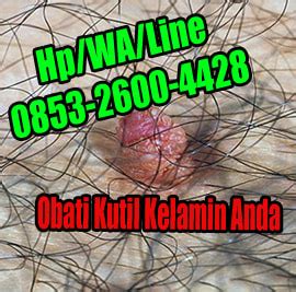 Obat Kutil Kelamin Obat Kutil Kelamin Herbal Alami