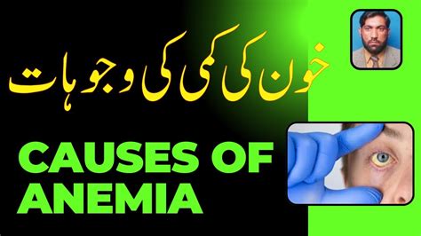 What Are The Causes Of Anemiaخون کی کمی کی وجوہات Youtube