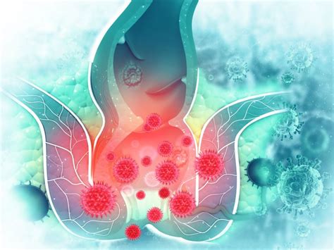 Analkarzinom Symptome Und Behandlung Von Analkrebs