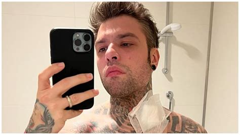 Fedez Ricoverato In Ospedale Lindiscrezione Che Allarma I Fan