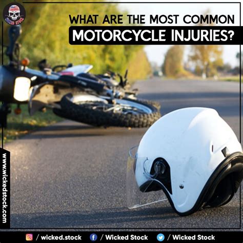 What Are The Most Common Motorcycle Injuries Wicked Stock