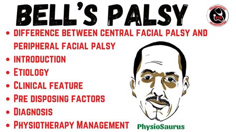 Bells Palsy Facial Palsy Etiology Clinical Feature Physio