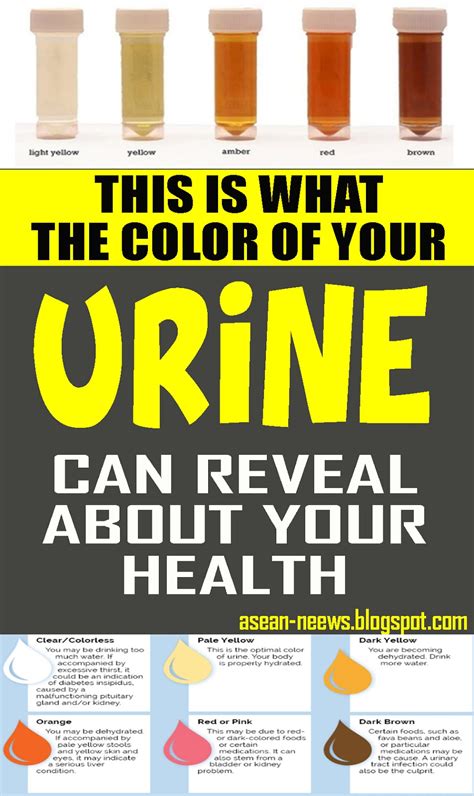 What The Color Of Your Urine And Frequent Urination Can Tell You About Your Health