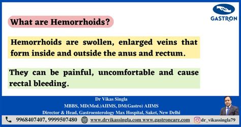 Hemorrhoids Types Symptoms And Preventions Gastron