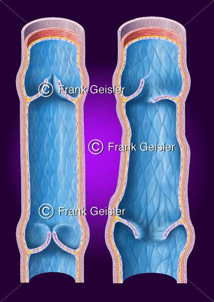 Funktion Vene Mit Venenklappen Sowie Blutstau Bei Venenerkrankung