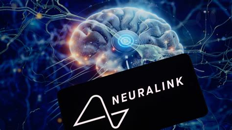 Musk S Neuralink Gets Approval For Brain Implant Trial Using Robotic Arm