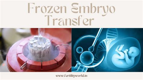 Frozen Embryo Transfer Fertilityworld