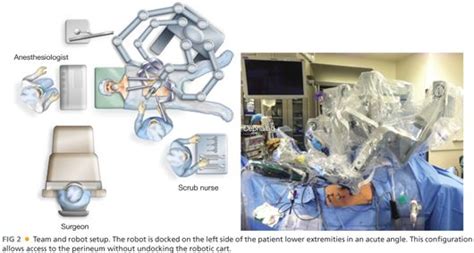 Abdominoperineal Resection Robotic Assisted Laparoscopic Surgery