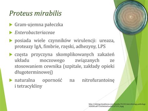 What Antibiotics Treat Proteus Mirabilis