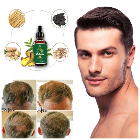 Hair Restore & Hair Growth Serum – VLC KART