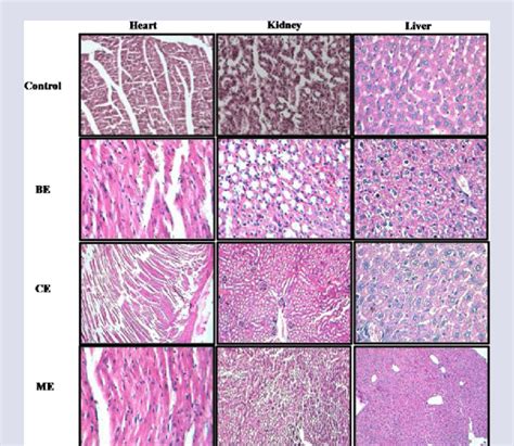 Representative Photomicrographs Showing Histopathological Changes In